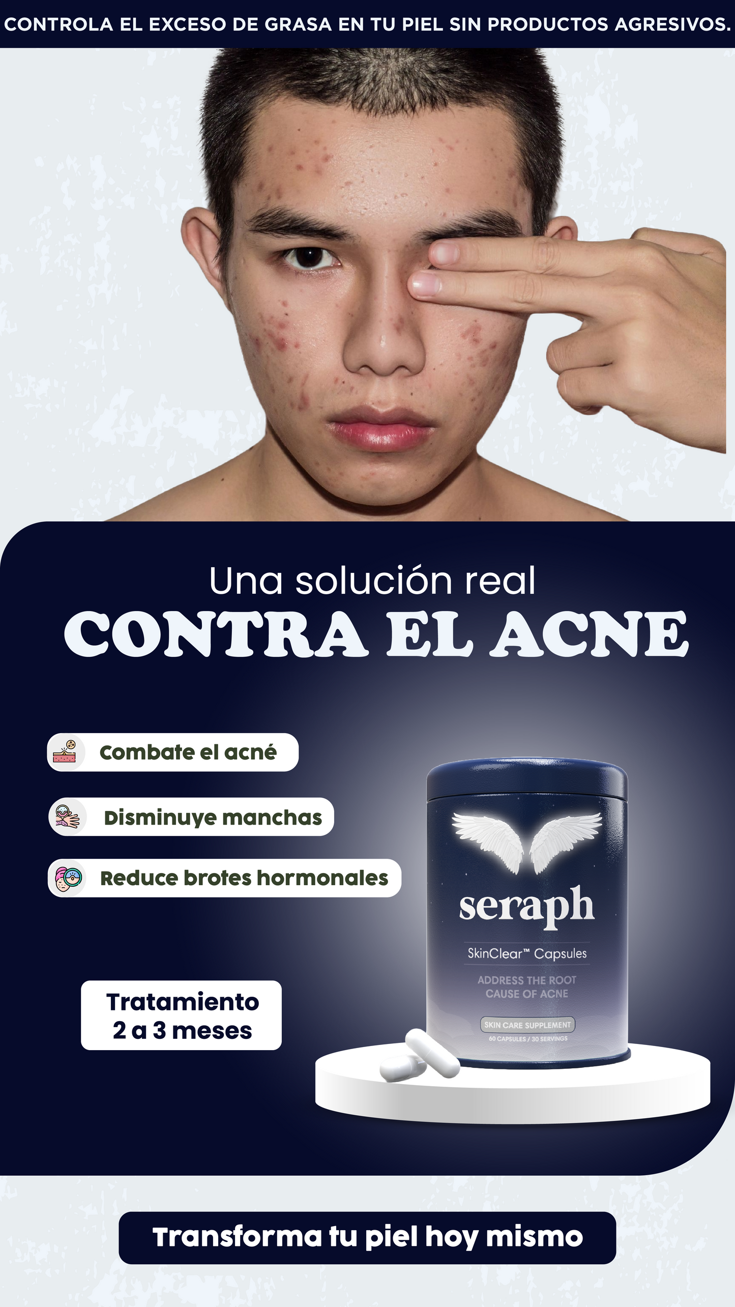Seraph| Elimina acné, marcas y grasa.